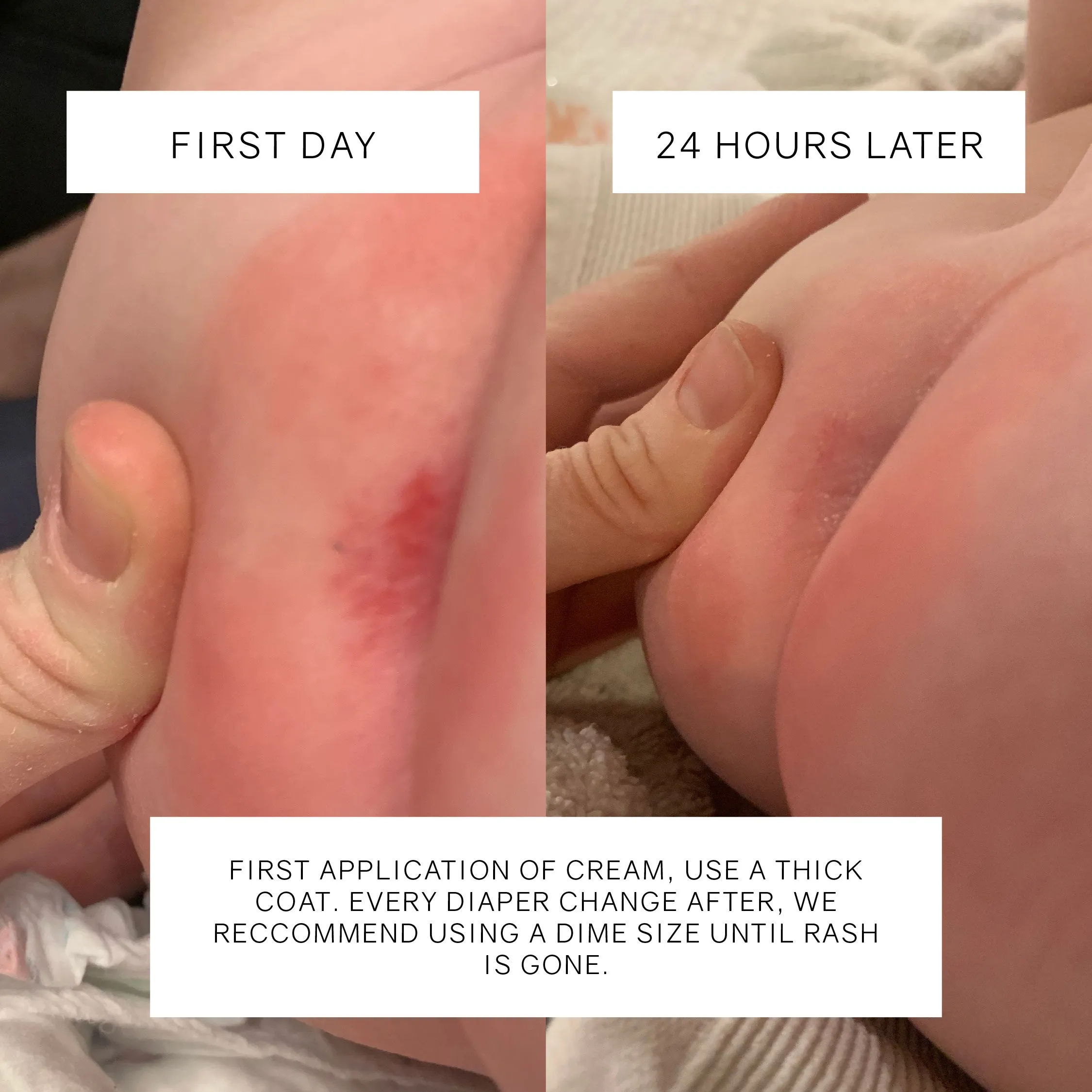 Diaper Crème