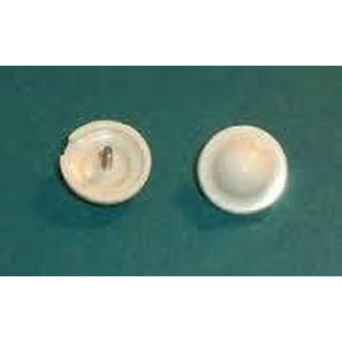 Higbee Buttons - White - 12/Bag